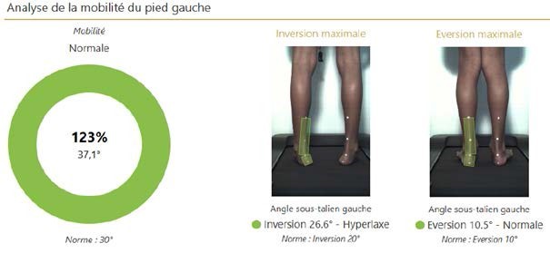 PIED PLAT ET SES TRAITEMENTS semelles orthop diques chirurgie